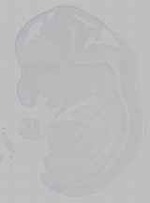 EMAGE:15793