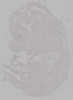 EMAGE:15793