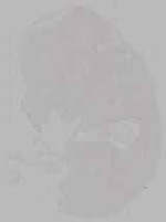 EMAGE:15793