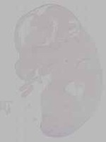 EMAGE:15793