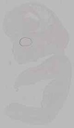 EMAGE:15793