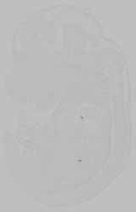 EMAGE:15795