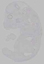 EMAGE:15796
