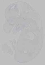 EMAGE:15796