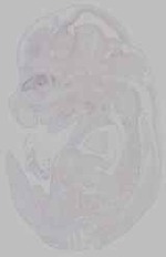EMAGE:15796