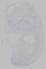 EMAGE:15796