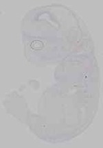 EMAGE:15796