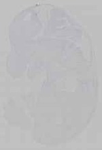 EMAGE:15798