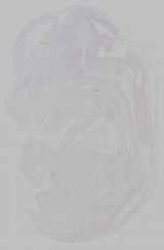 EMAGE:15798