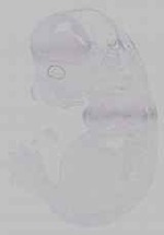 EMAGE:15798