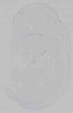 EMAGE:15801