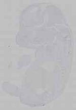 EMAGE:15806