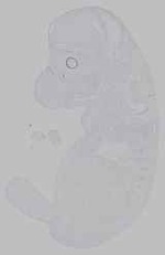 EMAGE:15806