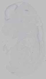 EMAGE:15809