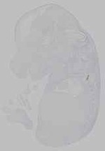 EMAGE:15816