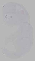 EMAGE:15824