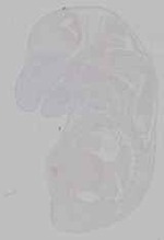 EMAGE:15873