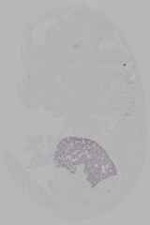 EMAGE:15880