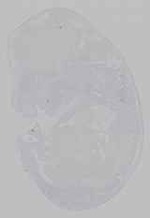 EMAGE:15908