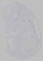 EMAGE:15911
