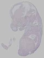 EMAGE:15951