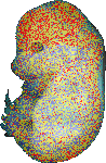 EMAGE:15957