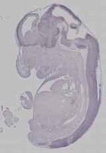 EMAGE:15957