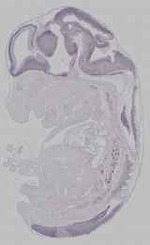 EMAGE:15957