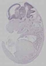 EMAGE:15957