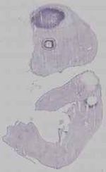 EMAGE:15957