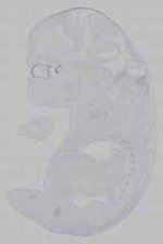 EMAGE:15958