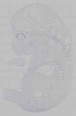EMAGE:15958