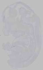 EMAGE:15958