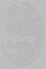EMAGE:15958