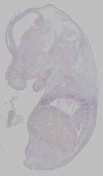 EMAGE:15958