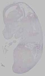 EMAGE:15958