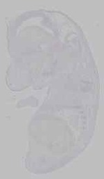 EMAGE:15958