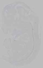 EMAGE:15959