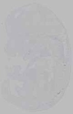 EMAGE:15959