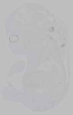 EMAGE:15967