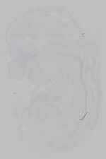 EMAGE:15991