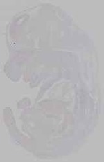EMAGE:16002