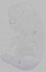 EMAGE:16004