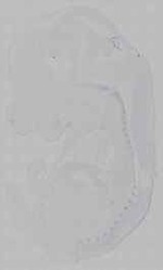 EMAGE:16004