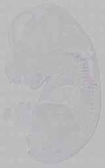 EMAGE:16004