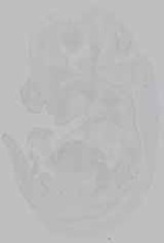 EMAGE:16009