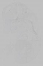 EMAGE:16010