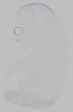 EMAGE:16017