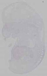 EMAGE:16038