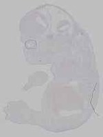 EMAGE:16039